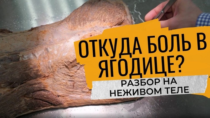 Седалищный нерв, Глубокая БОЛЬ в ягодице, разбор: НЕЖИВОЕ
