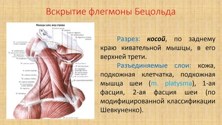 Возможная локализация и вскрытие флегмон шеи (без звука)