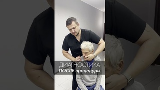 Недоворот головы очень сильный! Запущенный случай. Не мышечный спазм. Акупрессура подзатылочных мышц