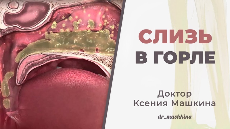 Слизь в горле. Причины, что